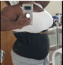 Snatch Me Up Bandage Wrap Waist Trainer photo review